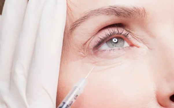 Under-Eye Fillers: What to Know About Tear Trough Treatment